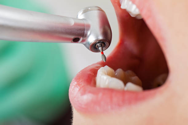 Best Emergency Dental Care for Abscessed Tooth in Lmerton, PA